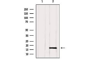 Western blot analysis of extracts from Rat muscle, using GMFG Antibody. (GMFG Antikörper  (Internal Region))