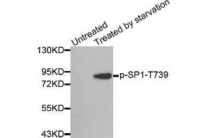 Western blot analysis of extracts from 3T3 cells, using Phospho-SP1-T739 antibody. (SP1 Antikörper  (pThr739))