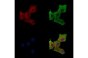 Phospho-EIF3J (Ser127) Antibody staining HepG2 cells(serum starvation treatment) by IF/ICC. (EIF3S1 Antikörper  (pSer127))