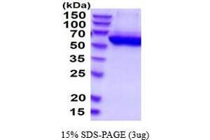 SDS-PAGE (SDS) image for Cat Eye Syndrome Chromosome Region, Candidate 1 (CECR1) (AA 30-511) protein (His tag) (ABIN5854577)