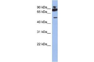 WB Suggested Anti-IKZF1 Antibody Titration:  0. (IKZF1 Antikörper  (Middle Region))