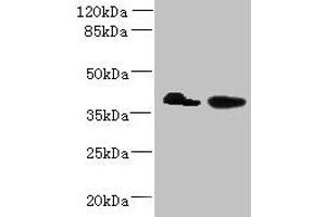 Western blot All lanes: L3HYPDH antibody at 8 μg/mL Lane 1: HepG2 whole cell lysate Lane 2: A549 whole cell lysate Secondary Goat polyclonal to rabbit IgG at 1/10000 dilution Predicted band size: 39 kDa Observed band size: 39 kDa (L3HYPDH Antikörper  (AA 13-312))