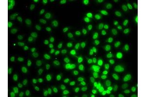 Immunofluorescence analysis of MCF-7 cells using SETD8 antibody (ABIN4905138). (SETD8 Antikörper)