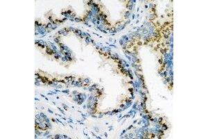 Immunohistochemical analysis of ARL6 staining in human prostate formalin fixed paraffin embedded tissue section. (ARL6 Antikörper)