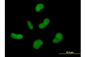 Immunofluorescence of purified MaxPab antibody to ZNF350 on HepG2 cell. (ZNF350 Antikörper  (AA 1-532))