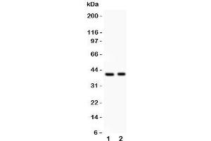 Western blot testing of IRF4 antibody and Lane 1:  HeLa;  2: Jurkat;  Predicted size: 51KD;  Observed size: 40KD (IRF4 Antikörper  (AA 272-451))