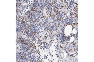 Immunohistochemical staining of human bone marrow with SLC10A5 polyclonal antibody  shows distinct nuclear and cytoplasmic positivity in subsets of bone marrow poietic cells. (SLC10A5 Antikörper)