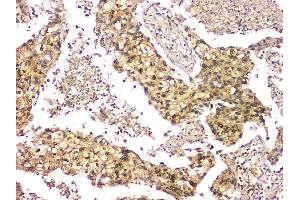IHC analysis of EIF6 using anti-EIF6 antibody (ABIN6719594). (EIF6 Antikörper  (AA 66-210))