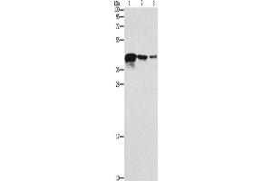 Western Blotting (WB) image for anti-Twinfilin, Actin-Binding Protein, Homolog 2 (Drosophila) (TWF2) antibody (ABIN2429403) (TWF2 Antikörper)