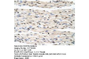 Rabbit Anti-HNRPDL Antibody  Paraffin Embedded Tissue: Human Muscle Cellular Data: Skeletal muscle cells Antibody Concentration: 4.