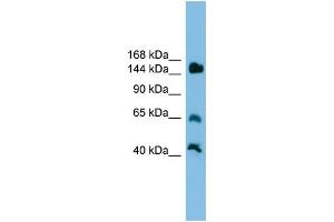 WB Suggested Anti-Jarid2 Antibody Titration: 0. (JARID2 Antikörper  (Middle Region))