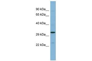 SET antibody used at 1 ug/ml to detect target protein. (SET/TAF-I Antikörper  (N-Term))