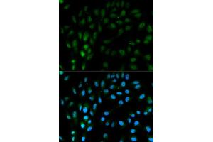 Immunofluorescence analysis of MCF7 cell using TFPI antibody.