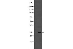 Western blot analysis of PROP1 expression in A431 whole cell lysate ,The lane on the left is treated with the antigen-specific peptide. (PROP1 Antikörper  (Internal Region))