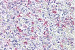 Immunohistochemistry with Spleen tissue at an antibody concentration of 5µg/ml using anti-EZH1 antibody (ARP38092_P050) (EZH1 Antikörper  (N-Term))