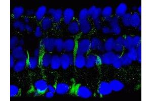 Immunostaining of salamander retina showing labeling of 14-3-3 protein when phosphorylated at Ser58 in Müller glial cells in green and DNA in blue. (YWHAB Antikörper  (pSer58))