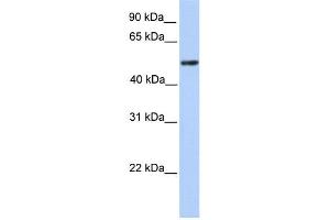 WB Suggested Anti-ZBTB9 Antibody Titration:  0. (ZBTB9 Antikörper  (C-Term))