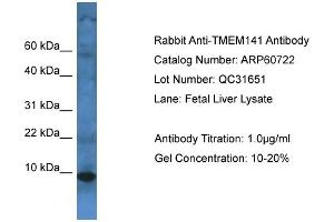 Western Blotting (WB) image for anti-Transmembrane Protein 141 (TMEM141) (C-Term) antibody (ABIN2774294) (TMEM141 Antikörper  (C-Term))
