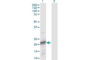 Western Blot analysis of ODAM expression in transfected 293T cell line by ODAM monoclonal antibody (M02), clone 2F8.