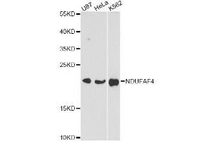 Western blot analysis of extracts of various cell lines, using NDUFAF4 antibody (ABIN6293778) at 1:3000 dilution. (NDUFAF4 Antikörper)