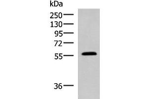 Western blot analysis of Mouse small intestines tissue lysate using PEPD Polyclonal Antibody at dilution of 1:1000 (PEPD Antikörper)