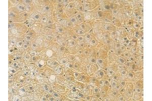 ABIN6257035 and ABIN6275629 at 1/100 staining human normal liver tissue by IHC-P.