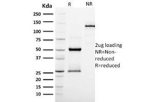 SDS-PAGE Analysis Purified EGFR Mouse Monoclonal Antibody (GFR/2596). (PODXL Antikörper  (AA 310-447))