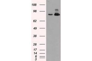 Western Blotting (WB) image for anti-Aconitase 2, Mitochondrial (ACO2) antibody (ABIN1496410) (ACO2 Antikörper)