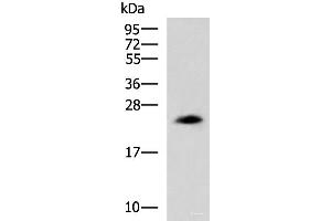 Western blot analysis of NIH/3T3 cell lysate using CLTB Polyclonal Antibody at dilution of 1:800 (CLTB Antikörper)