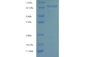 SDS-PAGE (SDS) image for Hypoalphalipoproteinemia, Primary (HYALP) (AA 36-490) protein (His-SUMO Tag) (ABIN5710408) (HYALP Protein (AA 36-490) (His-SUMO Tag))