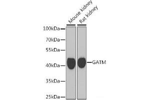 Western blot analysis of extracts of various cell lines using GATM Polyclonal Antibody at dilution of 1:1000. (GATM Antikörper)
