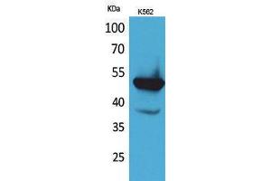 Western Blotting (WB) image for anti-Vitamin K-dependent protein C (PROC) (Internal Region) antibody (ABIN3178252) (PROC Antikörper  (Internal Region))