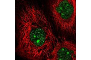 Immunofluorescent staining of A-431 cells with MAP3K9 polyclonal antibody  (Green) shows positivity in nucleus and nucleoli. (MAP3K9 Antikörper)