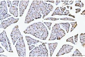 IHC analysis of NCL using anti-NCL antibody (ABIN7600662).