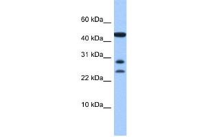 WB Suggested Anti-C20orf141 Antibody Titration: 0. (C20orf141 Antikörper  (Middle Region))