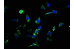 Immunofluorescence staining of SH-SY5Y cells with ABIN7147780 at 1:133, counter-stained with DAPI. (CNTF Receptor alpha Antikörper  (AA 106-342))