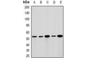 Western blot analysis of GLUD1 expression in Hela (A), HepG2 (B), mouse liver (C), mouse brain (D), rat kidney (E) whole cell lysates. (GLUD1 Antikörper)
