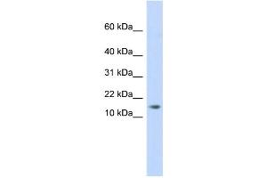 WB Suggested Anti-C11orf67 Antibody Titration: 0. (AAMDC Antikörper  (Middle Region))