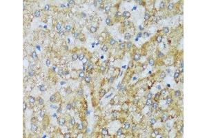 Immunohistochemistry of paraffin-embedded Human liver using C1QC Polyclonal Antibody at dilution of 1:100 (40x lens). (C1QC Antikörper)