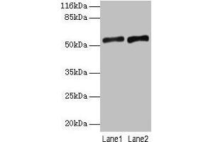 Western blot All lanes: SLC2A4 antibody at 2 μg/mL Lane 1: Mouse heart tissue Lane 2: Hela whole cell lysate Secondary Goat polyclonal to rabbit IgG at 1/10000 dilution Predicted band size: 55, 44 kDa Observed band size: 55 kDa (GLUT4 Antikörper  (AA 223-287))