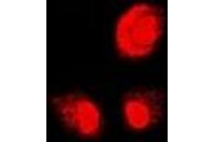 Immunofluorescent analysis of PSMB1 staining in U2OS cells. (PSMB1 Antikörper)