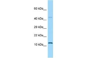 WB Suggested Anti-Hmga1 Antibody Titration: 2 ug/ml Positive Control: Rat Small Intestine