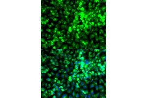Immunofluorescence analysis of A549 cells using EIF2AK4 antibody. (GCN2 Antikörper)