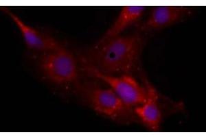 Image no. 1 for anti-Neurocan (NCAN) antibody (ABIN108596) (Neurocan Antikörper)