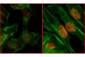 Immunofluorescence (IF) image for anti-Replication Protein A2, 32kDa (RPA2) (pSer4), (pSer8) antibody (ABIN7455212) (RPA2 Antikörper  (pSer4, pSer8))