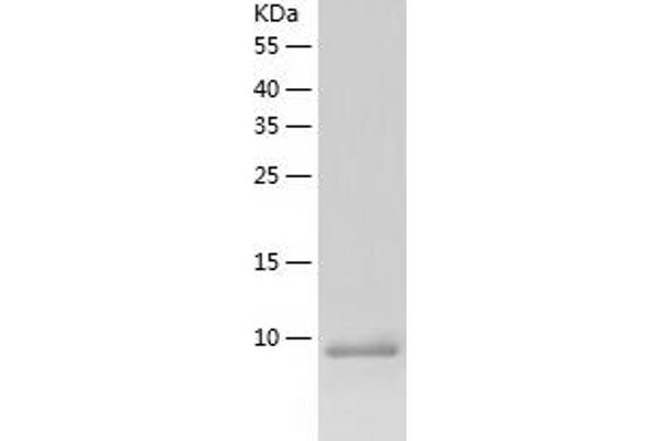 ACYP1 Protein (AA 1-99) (His tag)