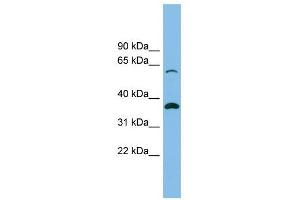 SLC25A4 antibody used at 1 ug/ml to detect target protein. (SLC25A4 Antikörper)