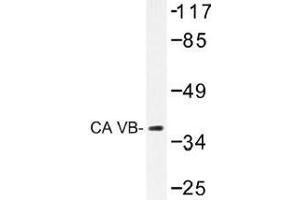 Image no. 1 for anti-Carbonic Anhydrase VB, Mitochondrial (CA5B) antibody (ABIN317824) (CA5B Antikörper)