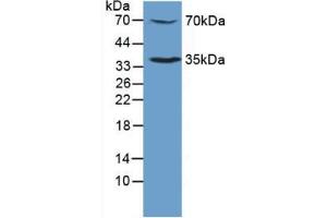 Figure. (MPL Antikörper  (AA 311-460))
