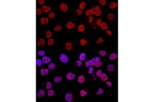 Confocal immunofluorescence analysis of Hela cells using WT1 Polyclonal Antibody (ABIN7271369) at dilution of 1:200. (WT1 Antikörper  (AA 1-302))